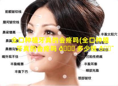 全口种植牙真的会疼吗(全口种植牙真的会疼吗 🐛 多少钱 🐯 )